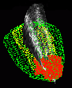 cardiology image